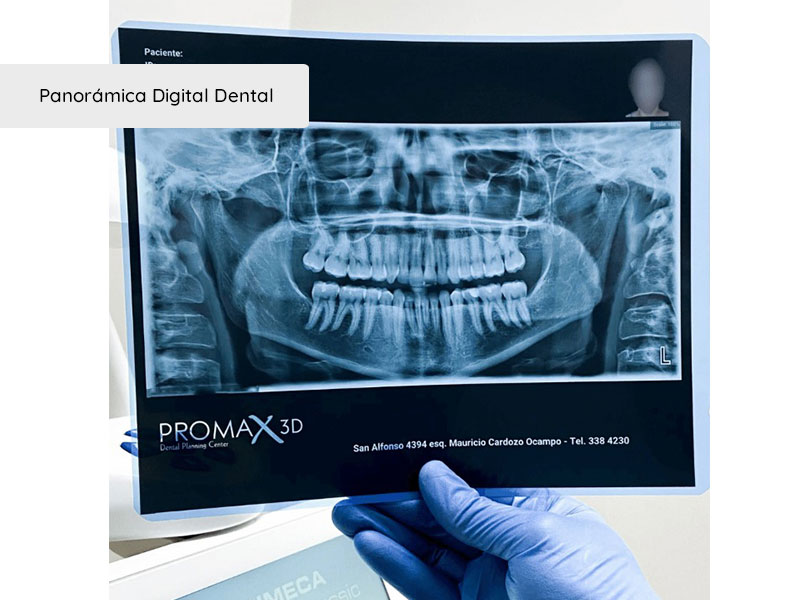 Panorámica Digital Dental